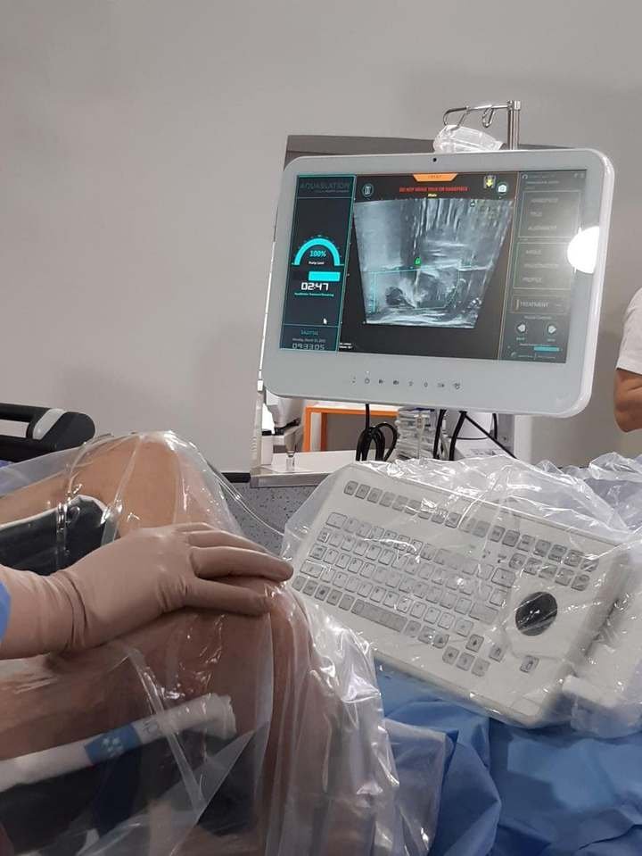 La Paz, terapia con Hidroablación Prostática (imagen 2)