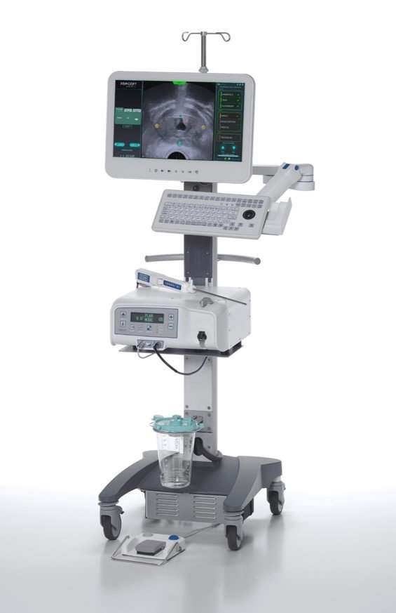 Aquabeam waterjet ablation system