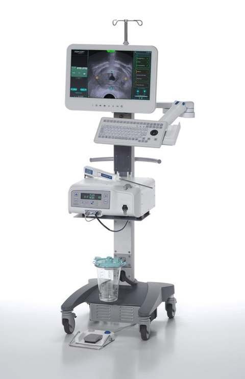 Hidroablación Prostática Sistema Aquabeam