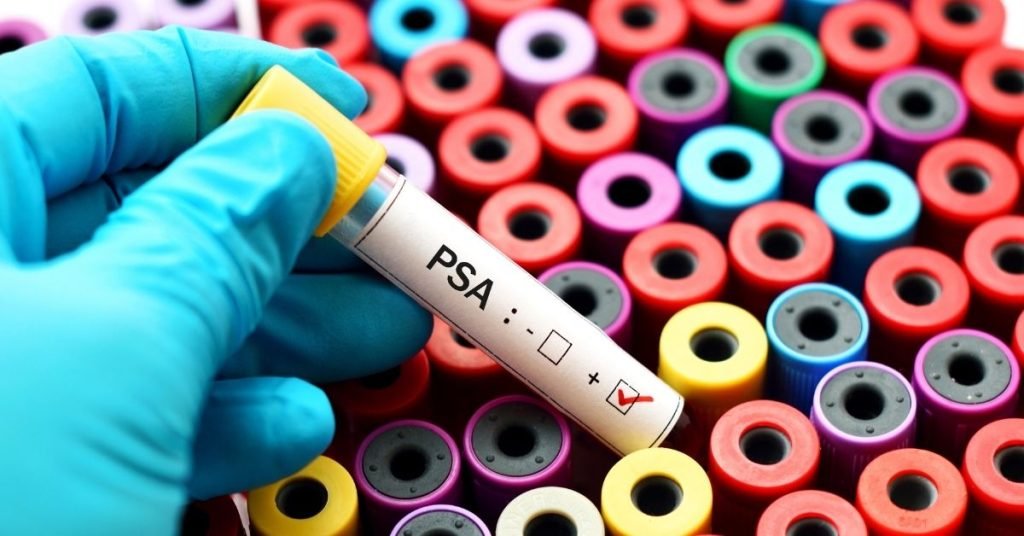 hiperplasia benigna de próstata y psa alto